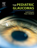 The Pediatric Glaucomas