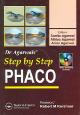 Step by Step Phaco (Book with 2 Mini CD-ROMs)