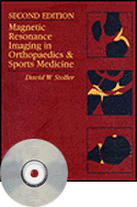 Magnetic Resonance Imaging in Orthopaedics & Sports Medicine CD-ROM for Windows and Macintosh