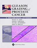 Gleason Grading of Prostate Cancer A Contemporary Approach Hardbound