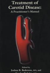 Treatment of Carotid Disease: A Practitioner's Manual