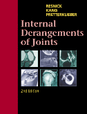 Internal Derangements of Joints, 2-Volume Set, 2nd Edition