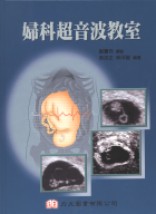 婦科超音波教室
