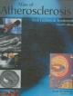 Atlas Of Atherosclerosis : Risk Factors & Treatment