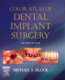 Color Atlas of Dental Implant Surgery, 2nd Edition