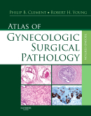 Atlas of Gynecologic Surgical Pathology, 2nd Edition