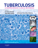 Tuberculosis: A Comprehensive Clinical Reference 2009