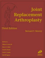 Joint Replacement Arthroplasty, 3rd Edition