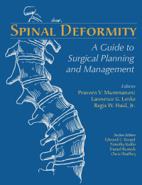 Spinal Deformity: A Guide to Surgical Planning and Management + DVD