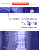 Arthritis and Arthroplasty: The Spine - Expert Consult - Online, Print and DVD 2010