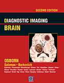Diagnostic Imaging: Brain  2/E Online + Book 2010