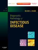 Diagnostic Pathology of Infectious Disease - Expert Consult: Online and Print