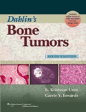 Dahlin's Bone Tumors General Aspects and Data on 10,165 Cases Hardbound + Website 6/E