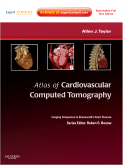 Atlas of Cardiovascular Computed Tomography: Expert Consult - Online and Print - Imaging Companion to Braunwald's Heart