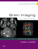 Brain Imaging, 2nd Edition - Case Review Series