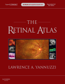 The Retinal Atlas - Expert Consult - Online and Print 2010