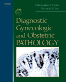 Diagnostic Gynecologic And Obstetric Pathology