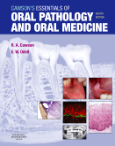 Cawson's Essentials of Oral Pathology and Oral Medicine, 8th Edition