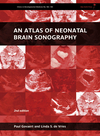 An Atlas of Neonatal Brain Sonography: (CDM 182-183), 2nd Edition 2010