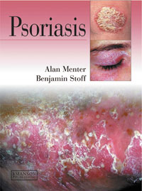 Psoriasis 2011