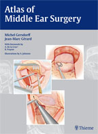 Atlas of Middle Ear Surgery  2011