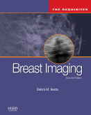 Breast Imaging, 2nd Edition The Requisites 2011