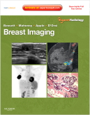 Breast Imaging Expert Radiology series Expert Consult- Online and Print 2011
