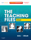The Teaching Files: Chest Expert Consult - Online and Print