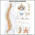 Human Spine Disorders Anatomical Chart Plastic Styrene Styrene