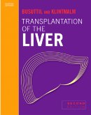 Transplantation of the Liver, 2nd Edition