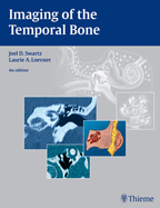 Imaging of the Temporal Bone 4/E 2009