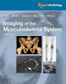 Imaging of the Musculoskeletal System, 2-Volume Set - Expert Radiology Series + CD