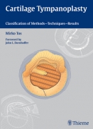 Cartilage Tympanoplasty Classification of Methods -- Techniques -- Results