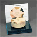 Skin Cancer Model
