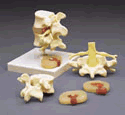 Lumbar Vertebrae Teaching Model
