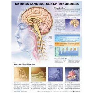 Understanding Sleep Disorders Anatomical Chart Laminated