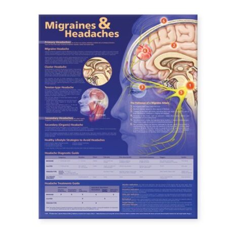 Migraines and Headaches Anatomical Chart Laminated