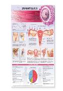 Infertility Anatomical Chart Laminated