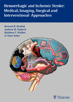 Hemorrhagic and Ischemic Stroke: Medical, Imaging, Surgical and Interventional Approaches 2012