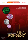 Diagnostic Atlas of Renal Pathology, 2nd Edition(Expert Consult - Online and Print) 2012 絕版