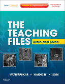 The Teaching Files: Brain and Spine Expert Consult - Online and Print 2012