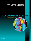 Musculoskeletal MRI 2nd Edition