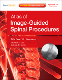 Atlas of Image-Guided Spinal Procedures Expert Consult - Online and Print 2012