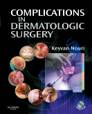 Complications in Dermatologic Surgery with CDROMs