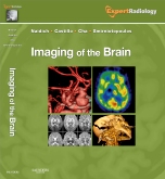 Imaging of the Brain Expert Radiology Series 2013