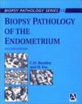 Biopsy Pathology of the Endometrium