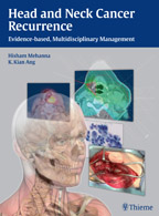 Head and Neck Cancer Recurrence Evidence-based, Multidisciplinary Management  2013