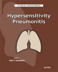 Clinical Focus Series: Hypersensitivity Pneumonitis