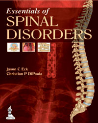 Essentials of Spinal Disorders 2014