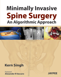 Minimally Invasive Spine Surgery: An Algorithmic Approach 2013